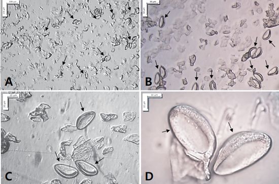 암컷 요충이 산란한 충란을 현미경으로 관찰한 모습. 이미지 출처: 질병관리본부