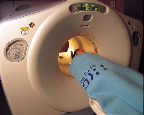 양전자단층촬영(PET) 모습. 사진 제공: 원자력병원