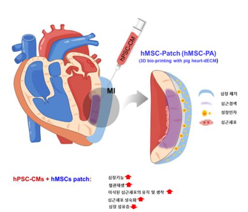 심장패치(중간엽줄기세포)와 심근세포(유도만능줄기세포) 이식을 이용한 심근경색 치료