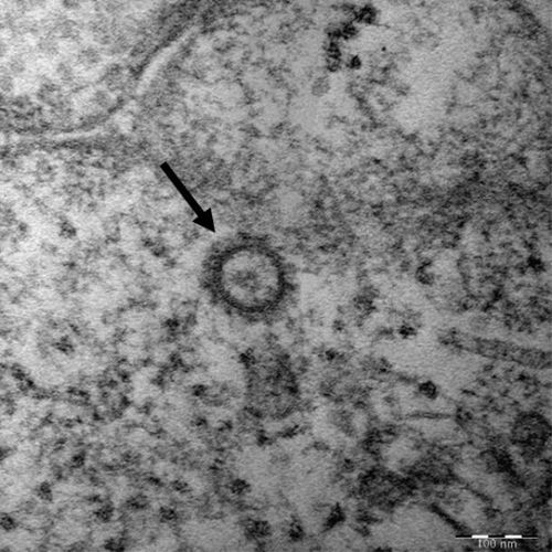 코로나19 바이러스(SARS-CoV-2)의 전자현미경 사진