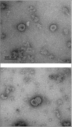 코로나19 바이러스항원(Spike)으로구성된바이러스유사체 투과전자현미경 (TEM) 이미지