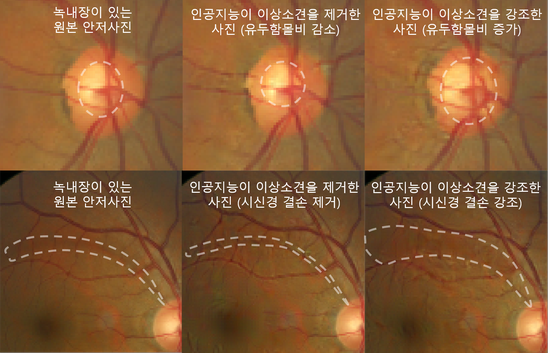 원본 안저사진(왼쪽)과 적대적 설명 방법론을 적용해 생성된 안저사진(가운데, 오른쪽)
