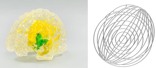 '아낫델' 환자맞춤형 뇌 모델(사진 왼쪽) 및 의료용 가이드(사진 오론쪽).