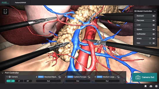 ▲㈜휴톰의 기술로 3D 이미지화된 환자고유의 해부학적 구조