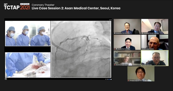 관상동맥 중재시술 국제학술대회 기간 라이브 시어터 세션에 참여한 의료진이 심혈관 중재시술 시연 영상을 보며 토론하고 있다.