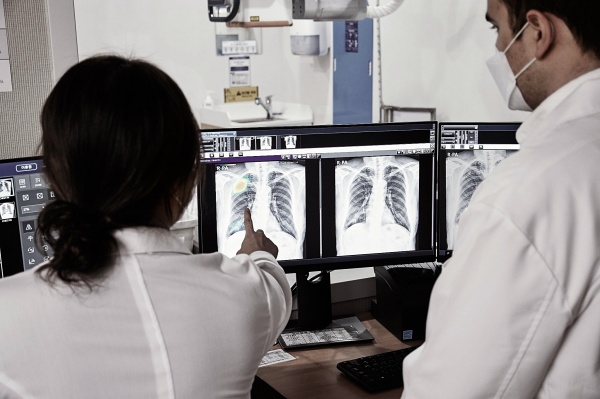 폐 질환 진단보조 소프트웨어 ‘루닛 인사이트 CXR’을 활용해 흉부 X-ray를 분석하는 모습