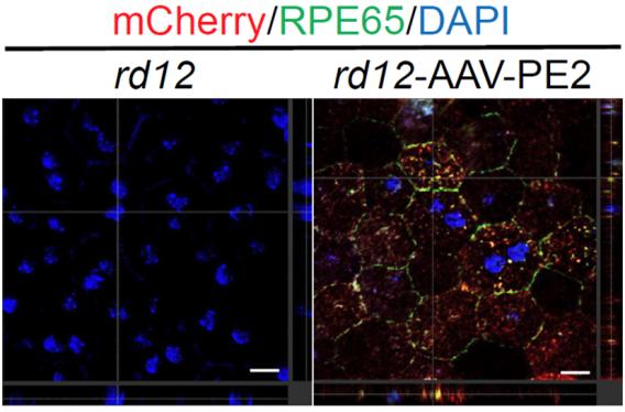 프라임 교정기를 통해 망막색소상피세포 내 RPE65 단백질 발현 회복(오른쪽) 효과 확인