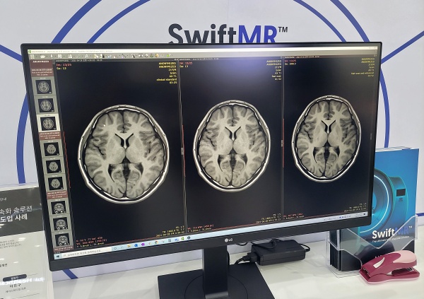 SwiftMR은 MRI 장비에서 가속화 프로토콜로 촬영한 저품질 영상을 PACS에 저장하면 해당 MRI 영상을 자동으로 처리해 고품질 영상으로 복원 후 PACS에 추가 저장한다.