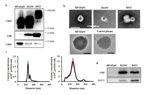 연구팀은 세포주에서 얻은 엑소좀의 특성 분석(western blotting, 전자현미경, NTA) 및 단백체 분석을 통해 선정한 바이오 마커 GCC2의 발현량을 엑소좀에서 확인한 결과 정상세포주인 HPAEpiC에서는 검출되지 않고 폐암세포주에서만 검출되는 것을 확인했다.