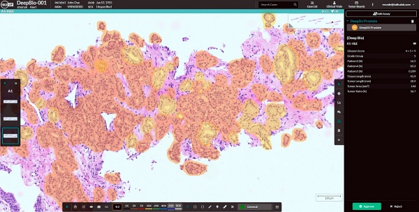 디지털 병리 플랫폼 ‘HALO AP’에서 구동된 ‘DeepDx Prostate’ 분석 화면