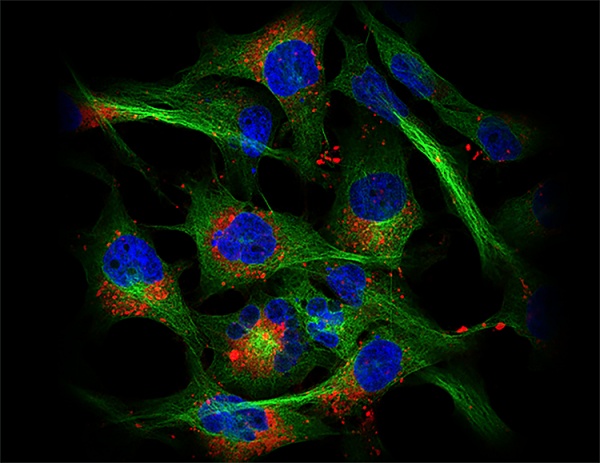 세포유래베지클(CDV)의 세포 내 흡수에 대한 공초점 현미경 이미지